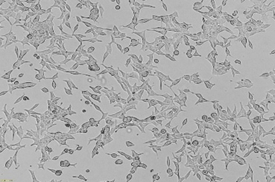 LNCaP cell line